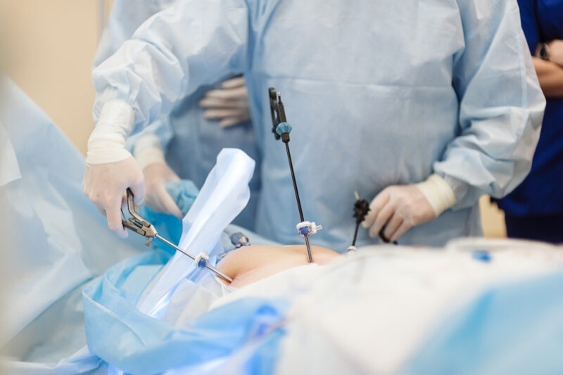 Гістеректомія